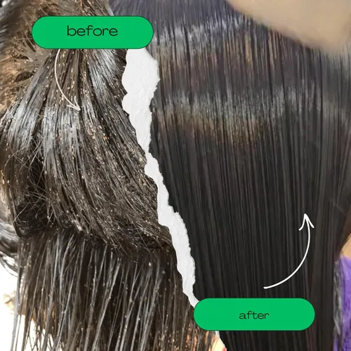 Vista 11 de My Hair Helpers Deluxe - Kit de tratamiento para piojos de cabeza de tamaño familiar, incluye peine de liendre, mousse, champú y acondicionador