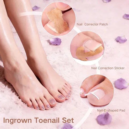 Vista 7 de Juego de corrector de uñas encarnadas con tiras correctoras, juego de herramientas profesionales de pedicura para uñas encarnadas con lima