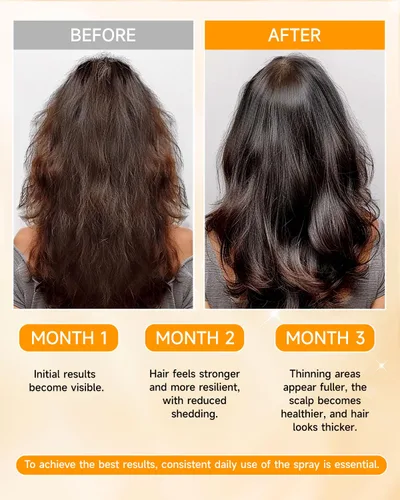 Vista 4 de Spray para el crecimiento del cabello, aceite en aerosol para el crecimiento del cabello, con Biota Orientalis, aceite de romero y biotina