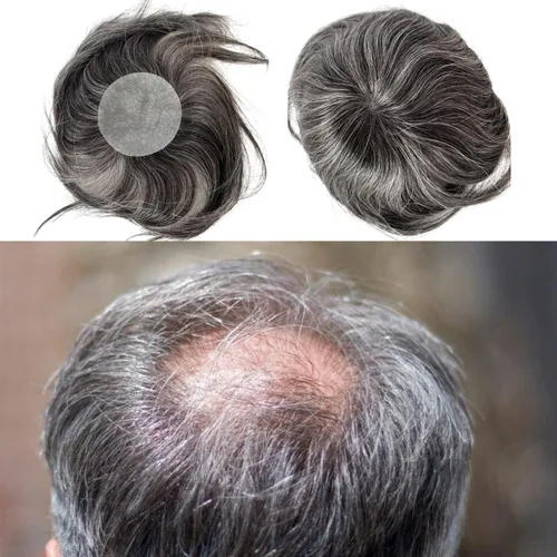 Vista 13 de Voloria Parche para el cabello calvo para hombres, 3.15 x 3.15 pulgadas, sistema de reemplazo de cobertura completa de piel de poliuretano