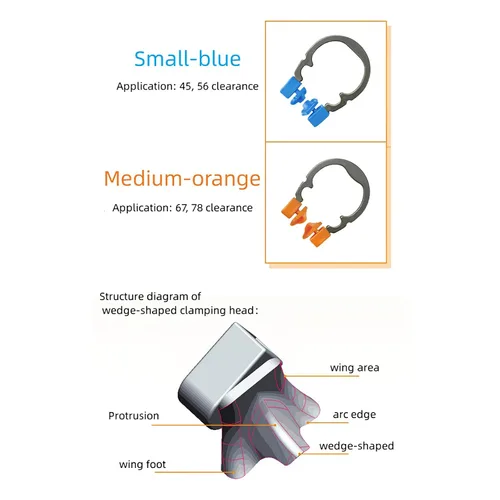 Vista 2 de Anillo de abrazadera de matrices dentales, anillo separador de anillo de sujeción elástico de níquel R2, clips de matriz contorneada seccional Azul