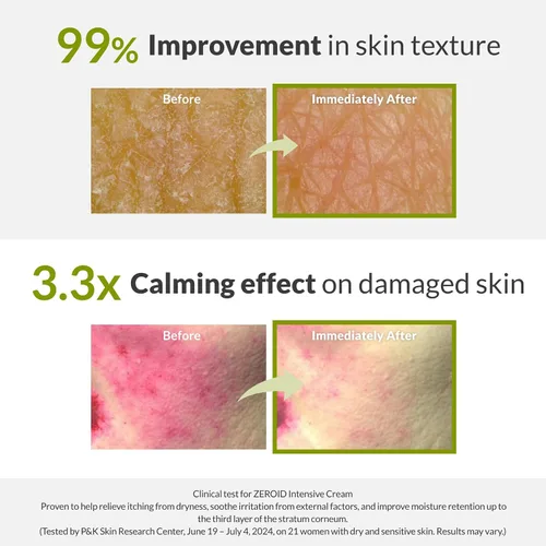 Vista 4 de ZEROID Crema intensiva Hidratante facial para piel seca y desordenada Crema facial para piel sensible Loción facial para reparación