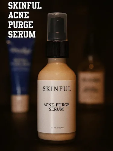 Vista 3 de Skinful Suero facial para piel propensa al acné - Suero anti acné para el acné facial y control de manchas, 2 onzas