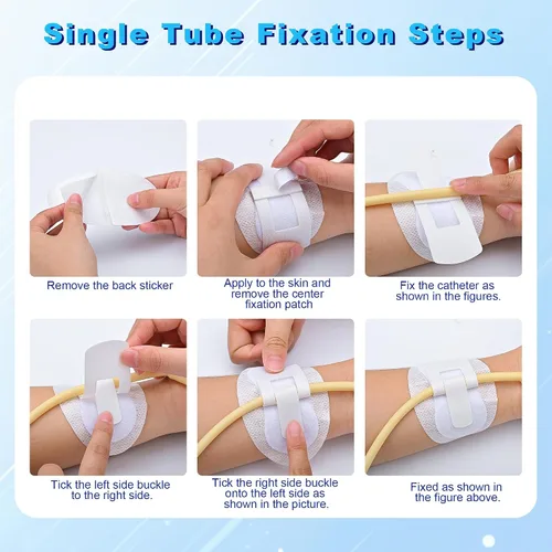 Vista 6 de Dispositivo de estabilización del catéter de Foley, adhesivo autoajustable para tubo de catéter, soporte adhesivo para bolsa de pierna urinaria