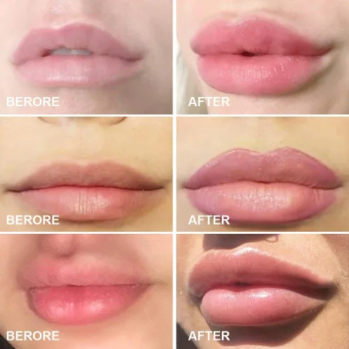 Vista 6 de Labios Potenciador Dispositivo Regordete Labios Silicona Forma de Pez Labios Plumper Labios Rellenar Labios Natural Pout Boca Herramienta Sexy Boca