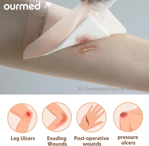 Vista 3 de Ourmed Soft Flex Apósitos de espuma de silicona (4 pulgadas x 4 pulgadas, paquete de 10) estériles, altamente absorbentes, impermeables, borde