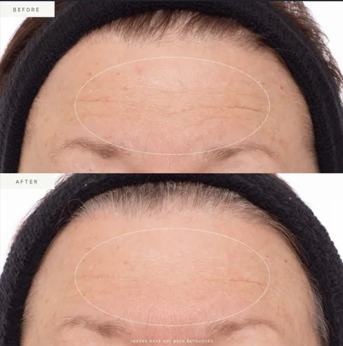 Vista 4 de KORA Organics Suero alternativo al retinol de células madre vegetales, suero facial reafirmante, reafirma los signos del envejecimiento, promueve