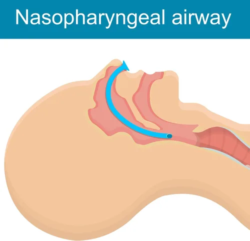 Vista 6 de ASA TECHMED Kit de vía respiratoria nasal 0.276 in Tratamiento médico nasofaríngeo trauma vías respiratorias - Primeros auxilios Rescate