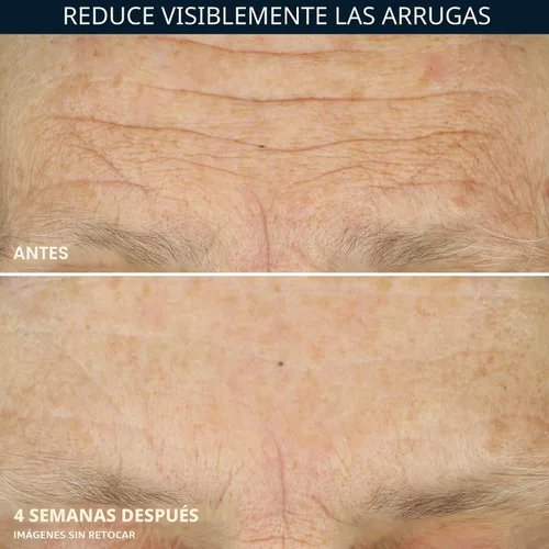 Vista 5 de RoC Crepe Repair Crema hidratante facial diaria antienvejecimiento y crema reafirmante para el cuello (1.7 onzas) + cápsulas suavizantes RoC Retinol