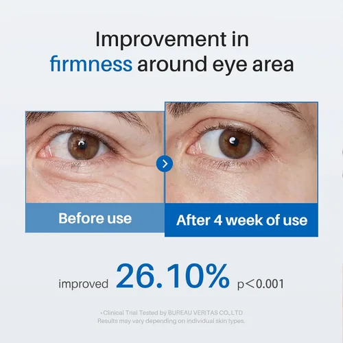 Vista 5 de SPODARE Crema de ojos con cafeína, crema debajo de los ojos para ojeras, bolsas hinchadas y hinchadas, líneas finas de arrugas, suero de rodillo