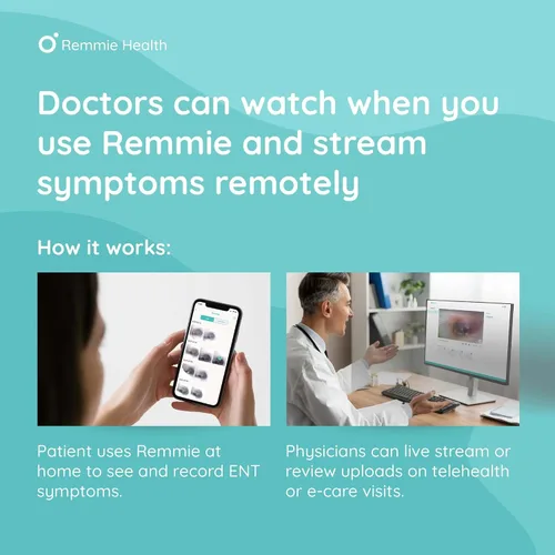 Vista 5 de Cámara inalámbrica con otoscopio para oído - Remmie 3 Otoscopio inteligente registrado por la FDA de próxima generación con cámara de luz