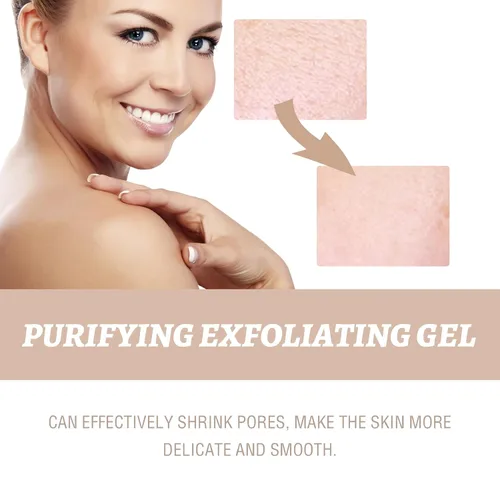 Vista 3 de Gel exfoliante purificador, gel para exfoliar la piel para rostro y cuerpo, exfoliante de limpieza profunda, exfoliante facial hidratante, removedor