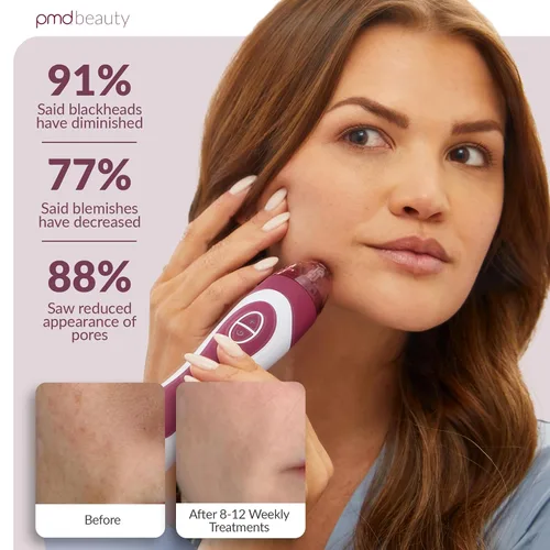 Vista 4 de PMD Beauty Personal Microderm Elite Pro - At-Home Use, Facial Exfoliator Tool, Microdermabrasion Machine Kit for Face and Body Skincare