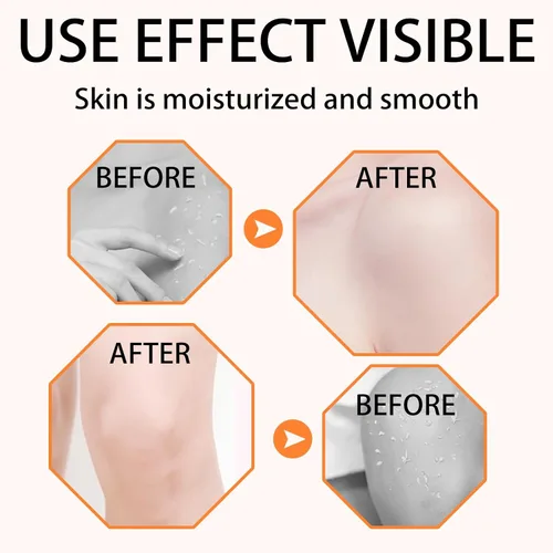 Vista 6 de Gel exfoliante naranja para cara y cuerpo, exfoliante de naranja 2026, limpieza profunda de poros, elimina puntos negros, hidrata la piel para todo