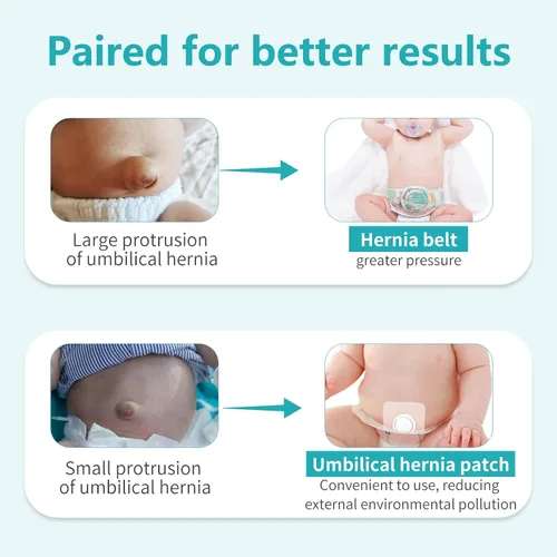 Vista 7 de Parches para el ombligo del bebé (5 piezas), moldeador de ombligo con almohadillas de algodón impermeables, imprescindibles para bebés, envoltura
