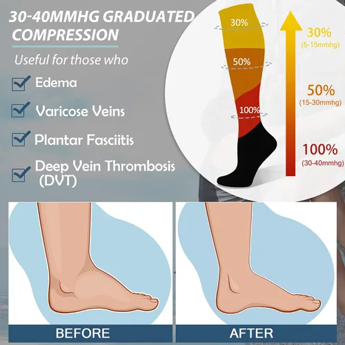 Vista 4 de FULLSOFT Calcetines de compresión graduados médicos de 30-40 mmHg para mujeres y hombres, calcetines de circulación hasta la rodilla, calcetines