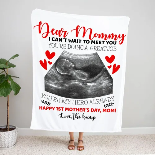 Vista 4 de Manta de fotos personalizada con ecografía para padres, manta de ultrasonido personalizada para primera vez, mamá y papá, imagen de ecograma