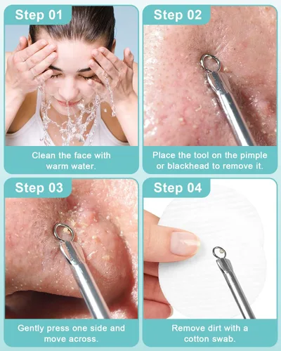 Vista 6 de Herramientas removedoras de puntos negros para Face EZBASICS Profesional Extractor de Comedones de Acero Inoxidable para Manchas y Puntos Blancos