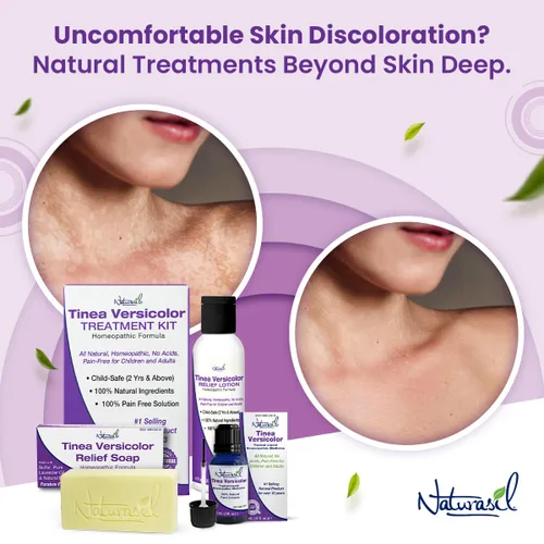 Vista 9 de Naturasil Tinea Versicolor Loción de tratamiento - Loción de azufre Max-Strength 10x para alivio antifúngico de acción rápida Alivia y restaura