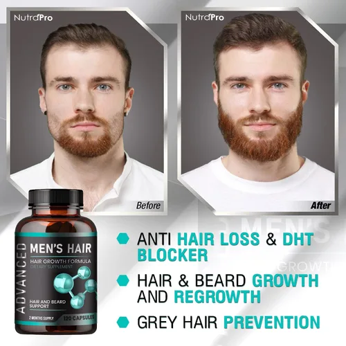 Vista 5 de Vitaminas para el crecimiento del cabello para hombres + limpieza y desintoxicación pulmonar. Apoya la salud pulmonar. Apoya la salud respiratoria.
