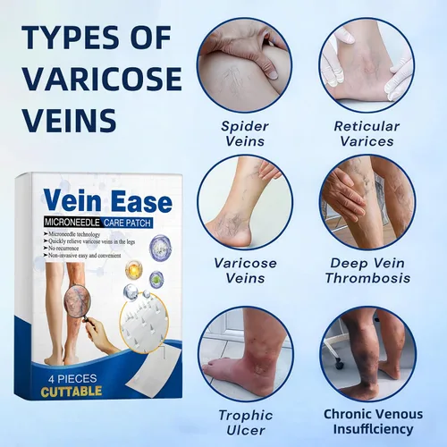 Vista 2 de Vein Ease Microdarts - Parche para el cuidado de las venas varicosas, 2 cajas para tratamiento profesional de venas varicosas para piernas, parche