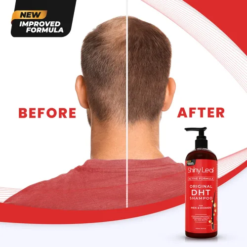 Vista 7 de DHT Blocker Champú y acondicionador - Para mujeres y hombres, fabricado en Estados Unidos, tratamiento contra la caída del cabello, con biotina