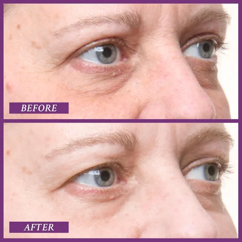 Vista 2 de PRAI Beauty Ageless Eye D-Crease, Crema de ojos antienvejecimiento para ojos de aspecto instantáneo sin edad, crema para debajo de los ojos