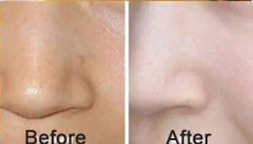 Vista 5 de AICHUN BEAUTY Lujosa mascarilla facial bio-colágeno de oro de 24 quilates (5 piezas)