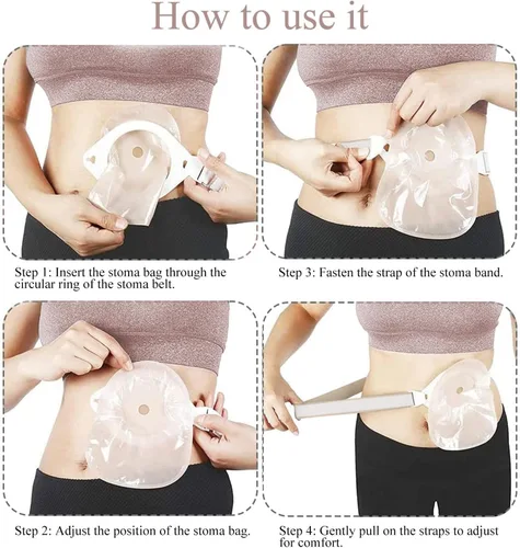 Vista 5 de Paquete de 3 cinturones de ostomía para mujeres y hombres, cinturón ajustable para ostomía que se fija de forma segura a la bolsa de ostomía, 1.1 x