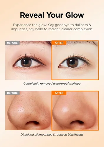 Vista 4 de Hanskin Limpiador facial de espuma limpiadora de poros, lavado facial suave y removedor de maquillaje, limpieza profunda de poros para piel