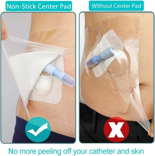 Vista 4 de 25 piezas impermeables para catéter de diálisis PD para heridas, vendajes de vestidor de isla para ducharse, línea de pícnic, pecho, peritoneal
