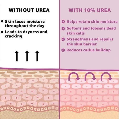 Vista 8 de Crema 10% de urea con aloe vera, aceite de jojoba y ácido salicílico, 5.1 fl oz hidratante para manos, pies, cara y cuerpo secas y agrietadas