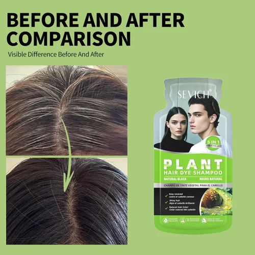 Vista 3 de SEVICH Champú de tinte para el cabello de ginseng 5 en 1 para mujeres y hombres Tratamiento de depósito de color 10 sobres de un solo uso
