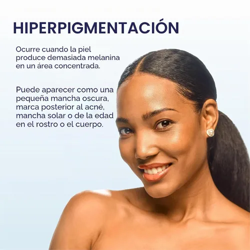 Vista 10 de Palmer's Skin Success Crema Antimanchas Desvanecedora para Piel Seca, 4.4 Onzas Helps Reduce Dark Spots and Age Spots, Evens Skin Tone & Balances