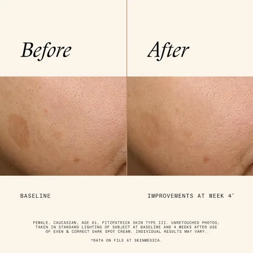 Vista 4 de Crema para manchas oscuras Even & Correct - Para reducir las manchas oscuras más difíciles