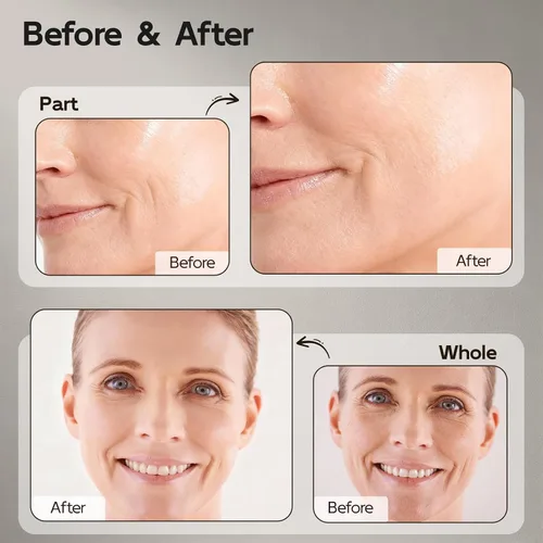 Vista 5 de Suero de retinol para cara y cuello, antienvejecimiento B5 suero facial rejuvenecedor con niacinamida + colágeno + ácido hialurónico, suaviza