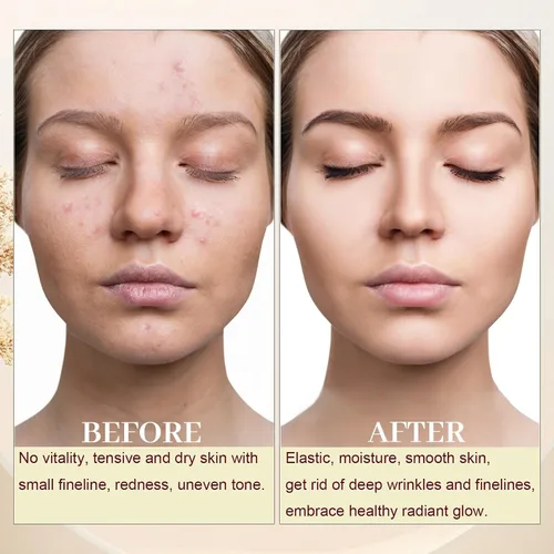 Vista 6 de Paquete de 3 aceites faciales Gua Sha para mujeres, aceite de rosa mosqueta, aceite facial orgánico con infusión de rosa, vitamina E y C