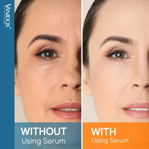 Vista 7 de VANIDOX Suero súper vitamina C para mujeres mayores de 70 años, fórmula todo en uno, fabricado en Estados Unidos, hidrata, reafirma, levanta y se