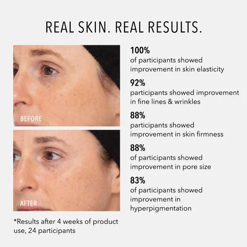 Vista 4 de HydroPeptide Retinol Routine Booster, 1% Solución Universal de Péptidos Complejo Tri-Retinol, 1 onza