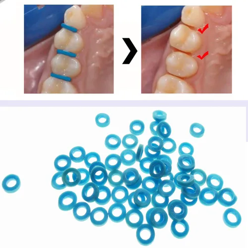 Vista 2 de 1000pcs/bag Separador de ortodoncia dental paquete a granel elástico ortodóntico separado lazos