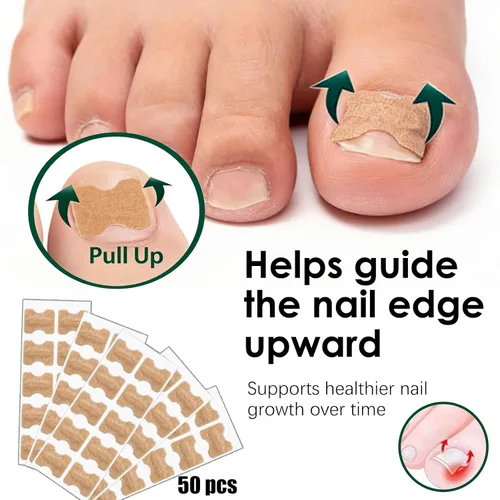 Vista 3 de Juego de corrector de uñas encarnadas, kit profesional de tratamiento de uñas encarnadas con tiras de corrección transpirables, parches curvos