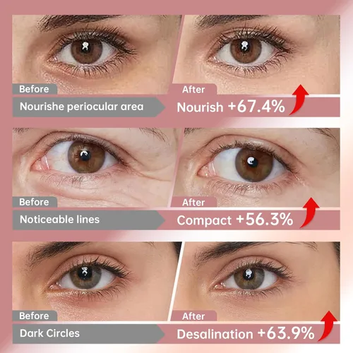 Vista 7 de Novoy - 7 pares de parches de ojos profundos de bio-colágeno – 6 en 1 retinol durante la noche parches para ojeras, hinchazón y arrugas 2%