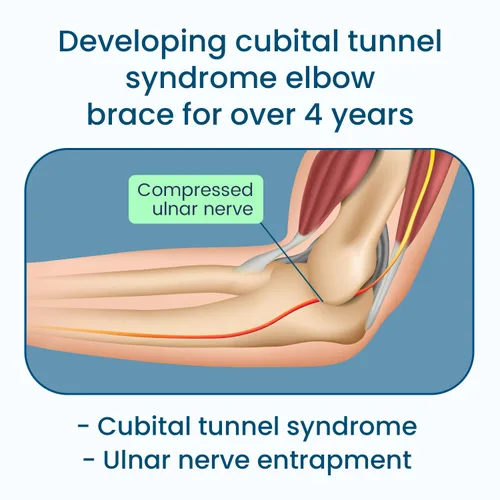 Vista 5 de Férula de Codo para Síndrome del Túnel Cubital para Atrapamiento del Nervio Ulnar