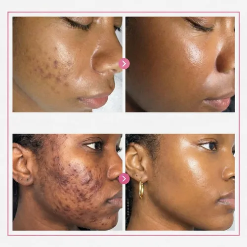 Vista 5 de Crema iluminadora, arbutina y crema facial de ácido tranexámico para el tono de piel desigual y el cuidado de la apariencia de las manchas oscuras