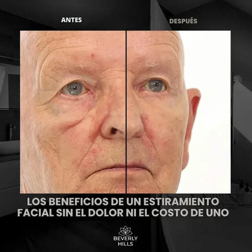 Vista 2 de Beverly Hills Tratamiento instantáneo de suero facial y suero para ojos para ojeras, ojos hinchados y arrugas