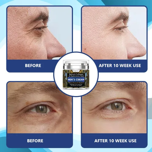 Vista 4 de VAITE Hidratante facial para hombre con colágeno, retinol, antienvejecimiento, crema antiarrugas para hombres, cuidado facial hidratante de la piel