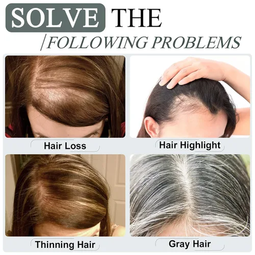 Vista 8 de SEGO Topes de cabello para mujeres de cabello humano real con cabello delgado, topes de cabello con clip frontal de 150% de densidad con base