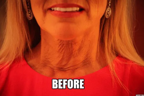 Vista 3 de NeckTITE Magic: el reafirmante de cuello instantáneo