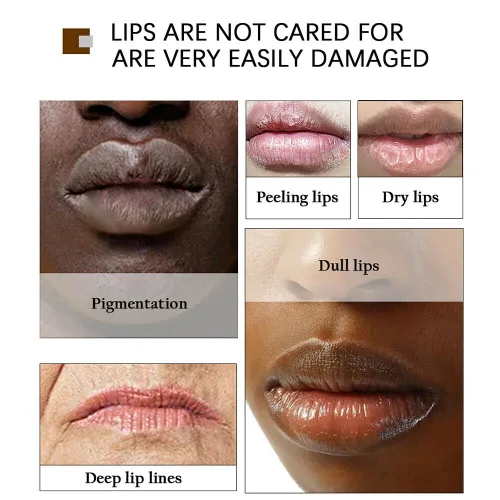 Vista 6 de Lips Pink Fresh - Crema blanqueadora rápida para eliminar los labios oscuros, 0.7 onzas líquidas
