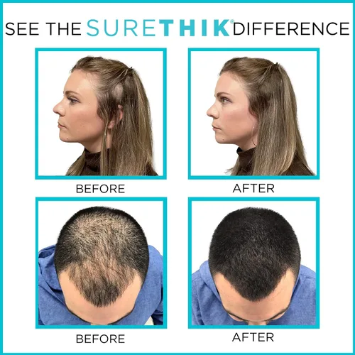 Vista 4 de SureThik Paquete de fibra espesante para el cabello de 0.53 oz (marrón claro) y spray de sujeción (3.4 oz)